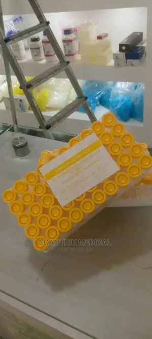 Fluoride Oxalate Non Vacuum Laboratory Collection Tube