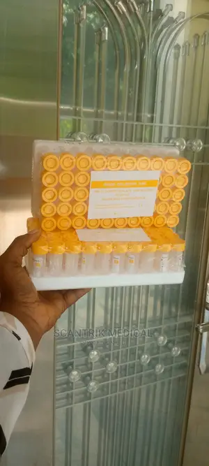 Fluoride Oxalate Non-Vacuum Blood Collection Tube, Yellow