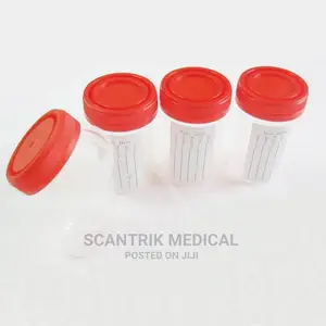 40ml Specimen Container Sputum Container Urine Sample