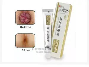 Powerful Chinese Hemorrhoids Pile Cream
