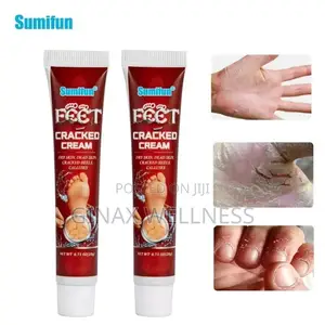 Cracked Cream for Cracked Heels, Dry Skin and Dead Skin