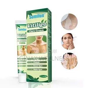 Vitiligo Care Cream