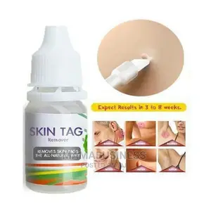 Skin Tag and Foot Corn Remover - 10g