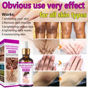 Dark Knuckle Whitening Serum