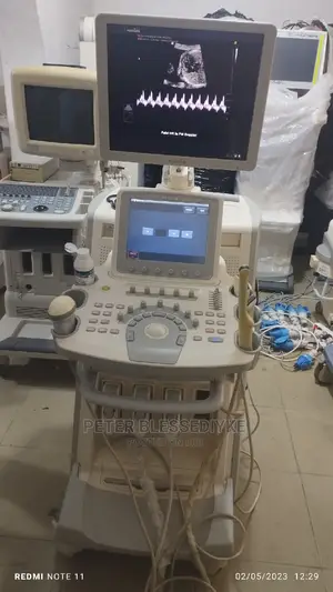 Sonoace Accuvix V20 (3d/4d)