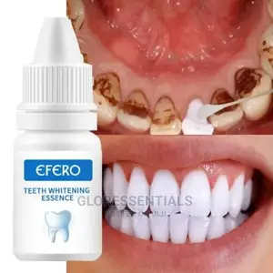 Teeth White Whitening Essence