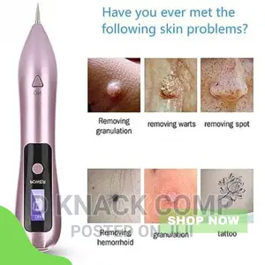LCD Laser Plasma Pen Face Skin Dark Tag Mole Tattoo Removal