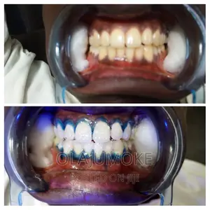 All Dental Service Is Available