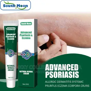 Advance Psoriasis and Eczema Cream for Itchy Skin Diseases