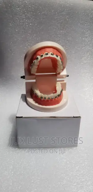 Fashion Teeth Braces