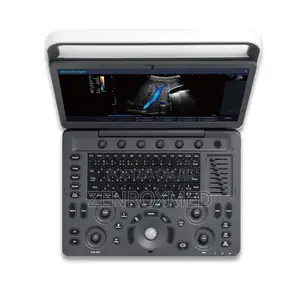 Ultrasound Machine - Sonoscape E2 - Color Ultrasound Scanner