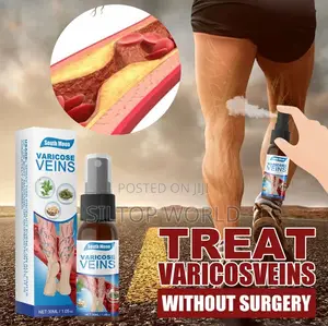 Varicose Veins