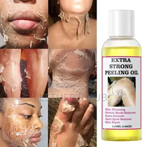 Yellow Peeling Oil for Dark Knuckles Stretch Marks Etc