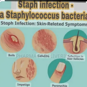 Treatment of Stubborn Staphylococcus Aureus Bacterias 
