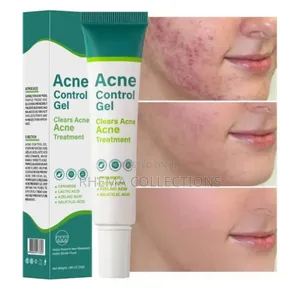 Acne Control Gel