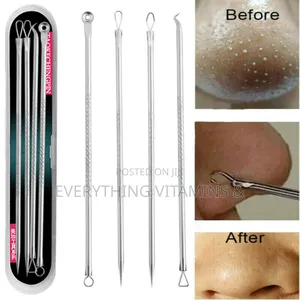 4pcs/Set Black Head Removal Toolkit