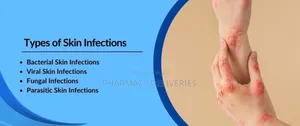 Treatment For Skin Parasitic Infection And Scabies Available