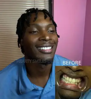 Teeth Cleaning, Teeth Whitening and Tooth Gems