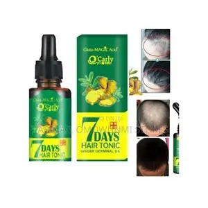 7 Days Ginger Hair Growth Oil