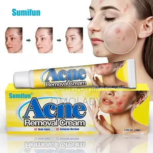 Sumifun Acne Removal Cream 30g