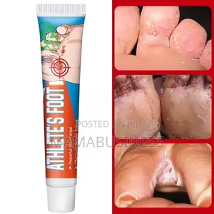 Sumifun Athlete's Foot Cream - 20g