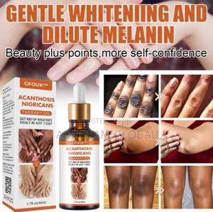 Dark Knuckle Whitening Serum–Superb Restoration Therapy Oil