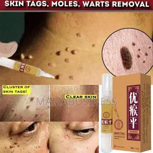Aonisen Skin Tag - 5ml