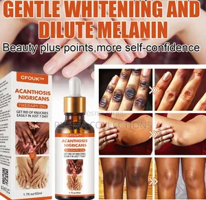 Dark Knuckle Whitening Serum