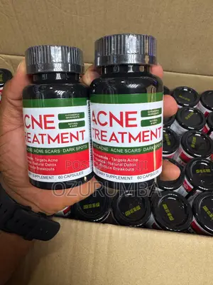 Acne Treatment