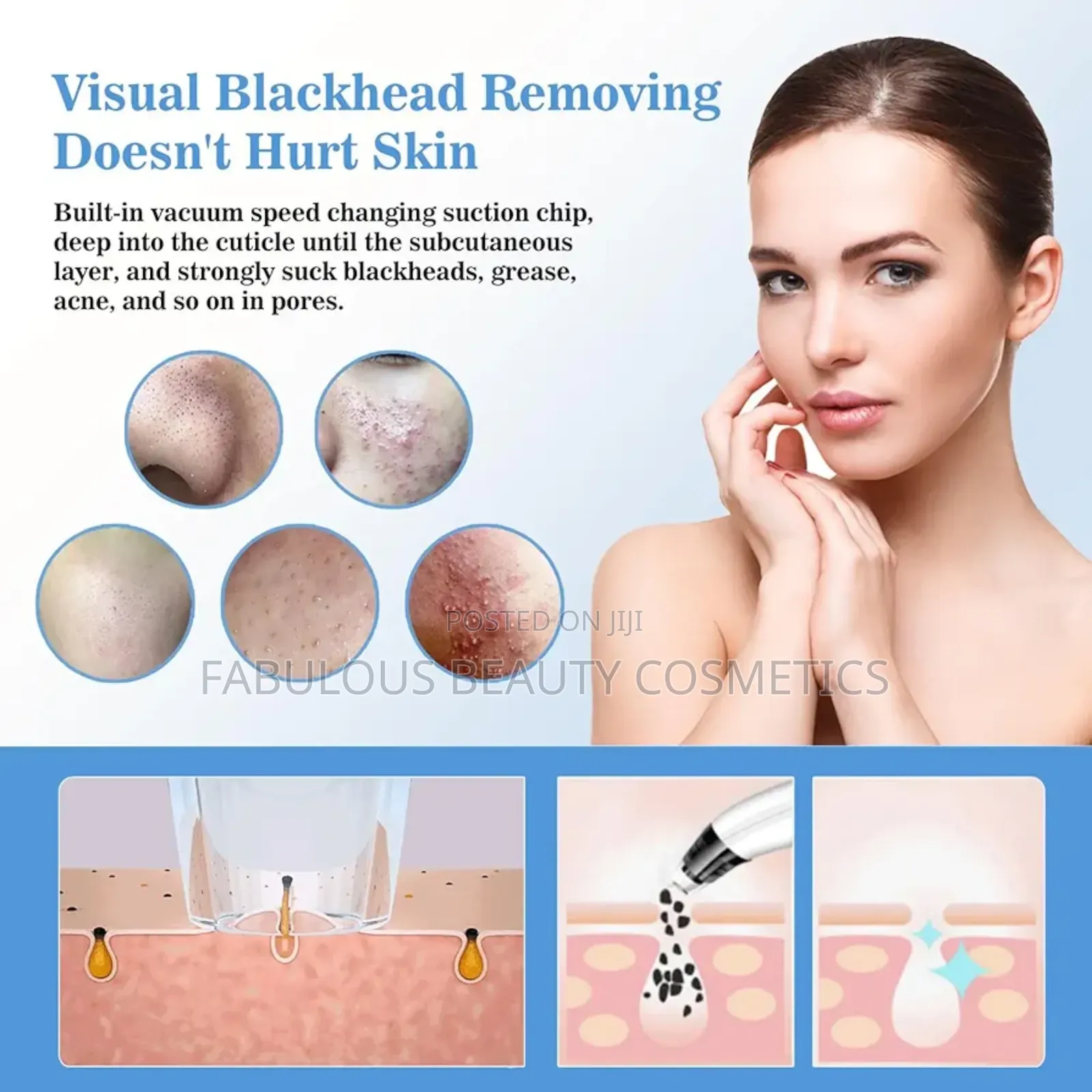 Blackhead Remover Vacuum, Pimple Extractor Tool