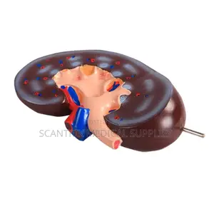 Kidney Model