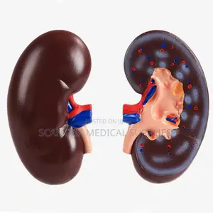 Medical Plastic Kidney Model