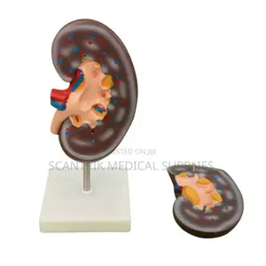 Educational Model Kidney