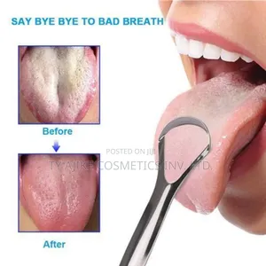 Metal Tongue Scraper - Set Of 2