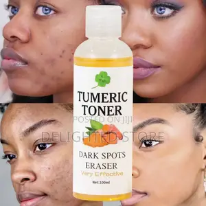 Turmeric Dark Spot Removing Toner