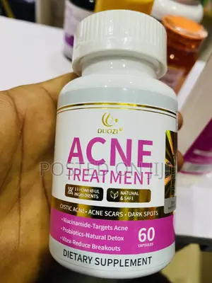 Douzi Acne Treatment for Stubborn Acne