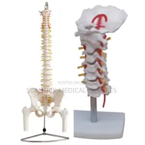 Cervical Backbone With Arterial System