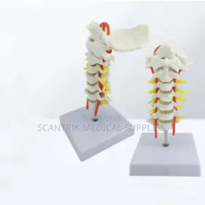 Cervical Skeletal and Arterial Anatomy