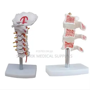 Cervical Spinal Column With Arteries