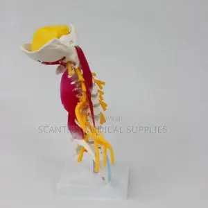 Cervical Vertebral Model With Vessels