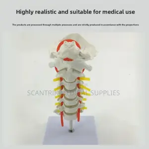 Upper Spinal Vertebrae and Arteries