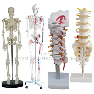 Cervical Framework With Carotid Vessels