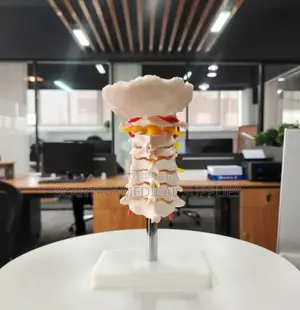 Vertebrae C1–C7 With Arterial Tracing