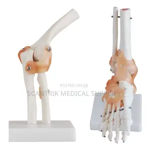 Academic Elbow Joint Ligament Anatomy Kit