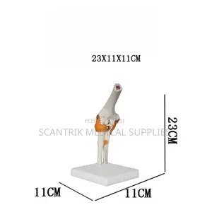 Portable Elbow Joint With Ligaments for Outreach Clinics