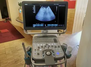 Siemens Acuson Nx2 Ultrasound Scanning Machine