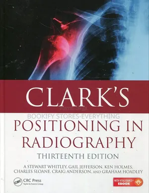 Clark's Positioning in Radiography