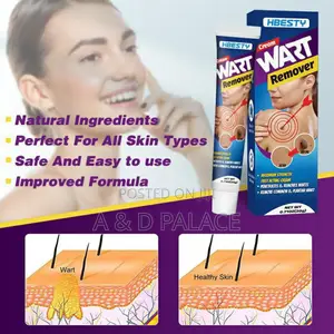 Hbesty Warts/Skin Tags Remover Cream