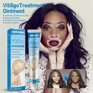 South Moon Vitiligo Cream Skin Topical Ointment