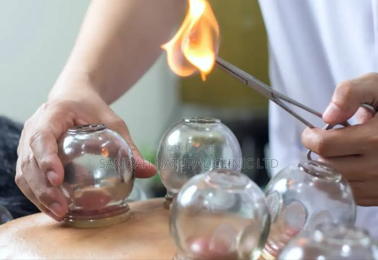 Glass Cupping Set
